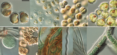 船体付着物から確認されたいろいろな微細藻の写真
